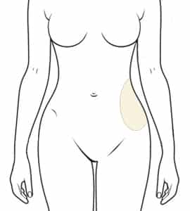 Love Handles Flanks