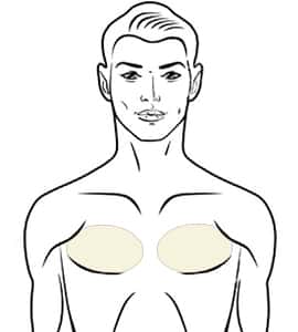 Male Breasts