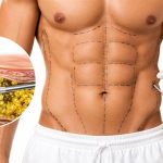 HD liposuction procedure for body contouring and muscle definition