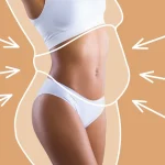 Good candidate for liposuction consultation at Medlounges